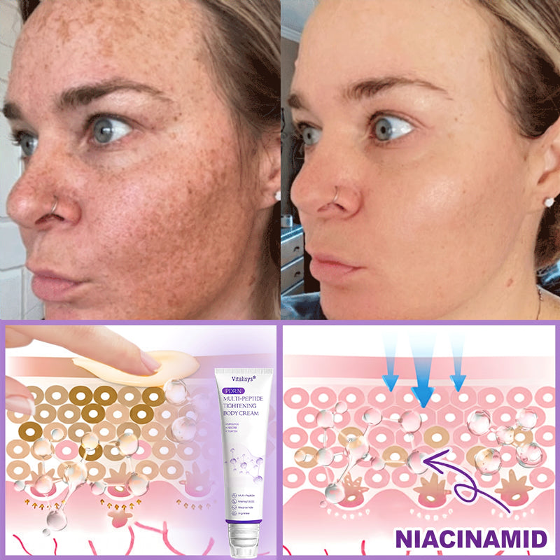 Vitalisys®❤️PDRN Multi-Peptide Massaging Body Roller Cream- Anti-aging, Hydrating, Skin Firming & Lifting, Skin Repair, Even Tone, Acne and Dark Spot Treatment, Wart and Mole Removal, and Psoriasis Relief