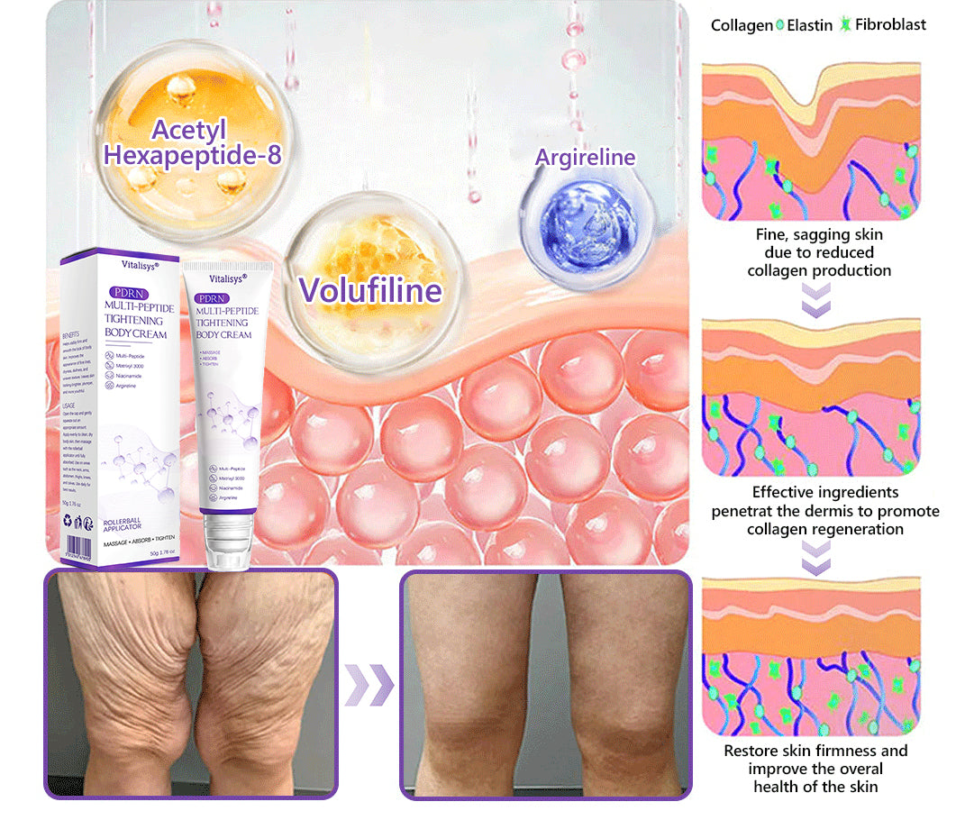 Vitalisys®❤️PDRN Multi-Peptide Massaging Body Roller Cream- Anti-aging, Hydrating, Skin Firming & Lifting, Skin Repair, Even Tone, Acne and Dark Spot Treatment, Wart and Mole Removal, and Psoriasis Relief